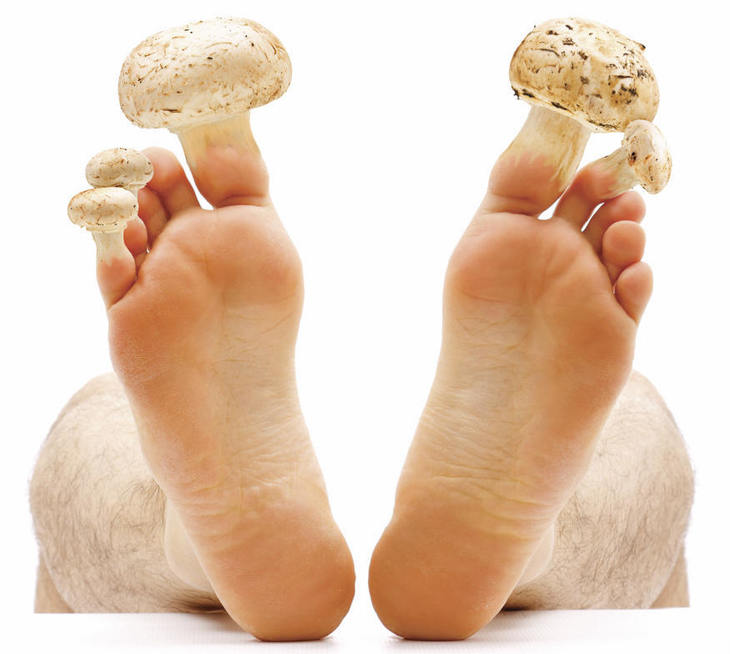 Tratamentul ciupercii unghiilor de la picioare cu remedii populare: recenzii și recomandări