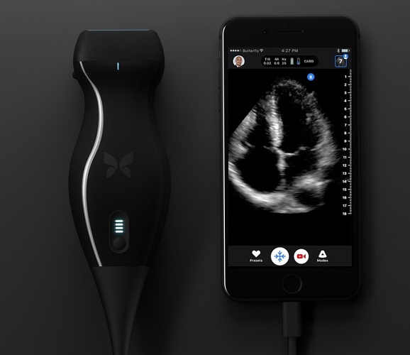  Ultrasound mudah alih
